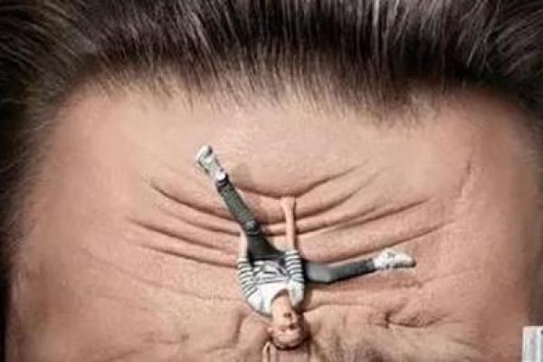 额头疤痕对事业和感情运势的潜在影响 额头疤痕对事业和感情运势的潜在影响