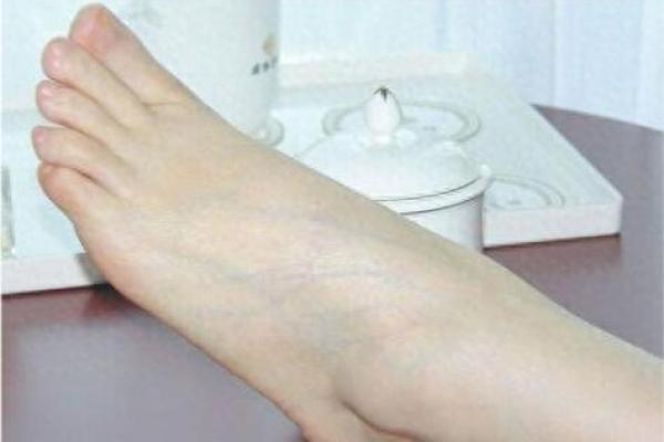 脚型和命运的关系:富贵命女性的足部标志 脚型和命运的关系:富贵命女性的足部标志