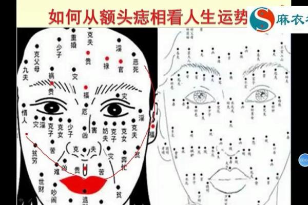 如何通过额头疤痕判断未来运势 如何通过额头疤痕判断未来运势