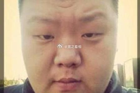 从额头疤痕看命运起伏与运势走向
